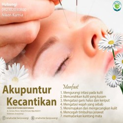 Gambar AKUPUNKTUR KECANTIKAN BANYUWANGI